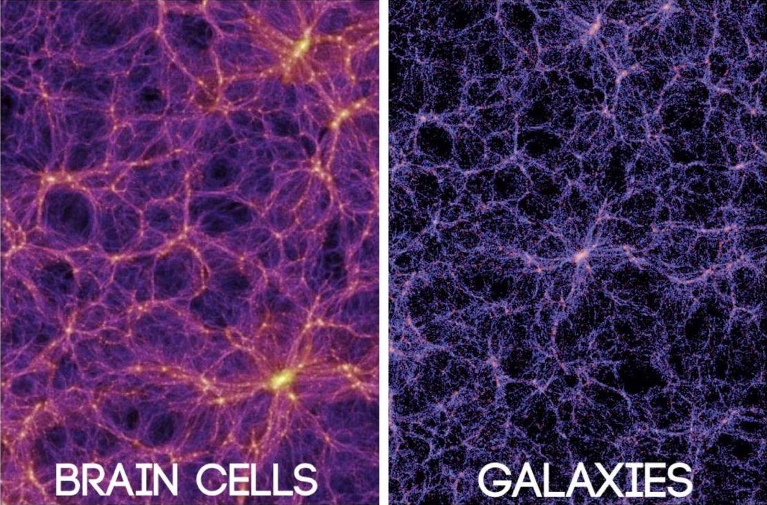 Similarities in the structures of galaxies and the human brain